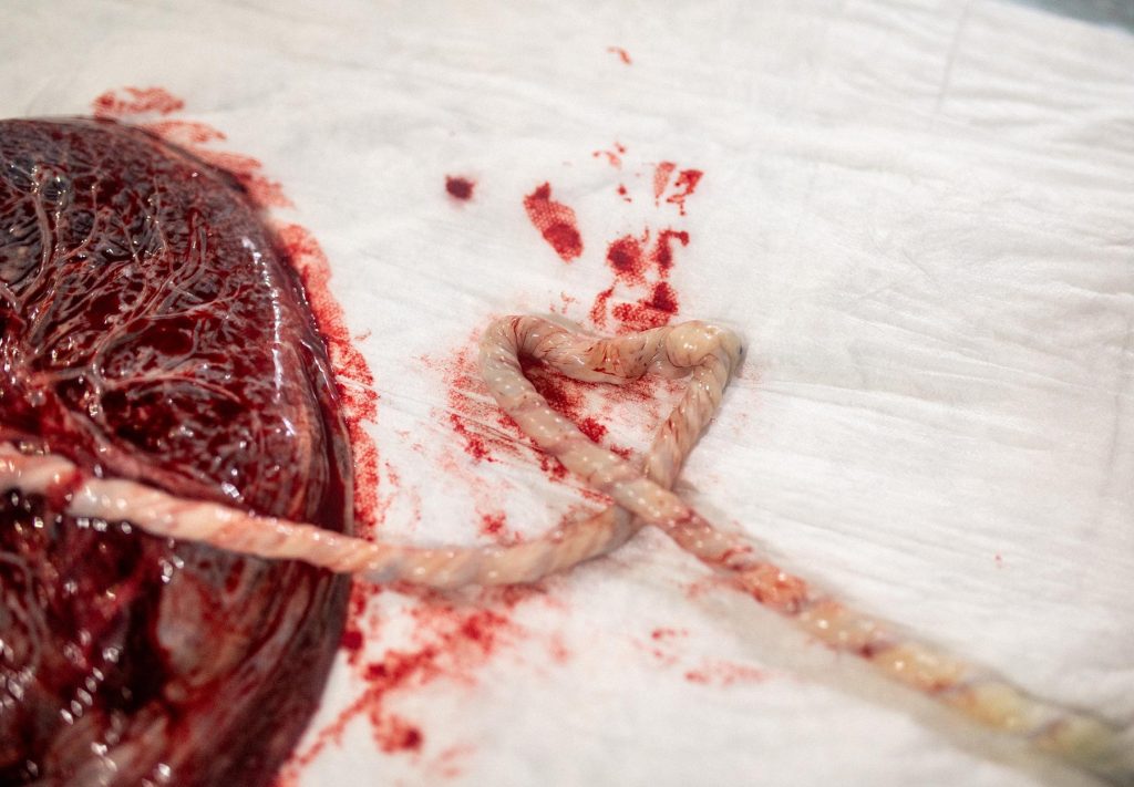 que es la placenta